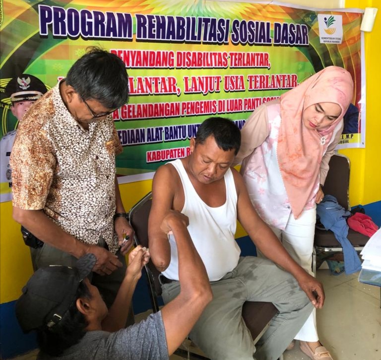 Program Rehabilitasi Sosial Pengukuran Kaki dan Tangan Palsu Disabilitas